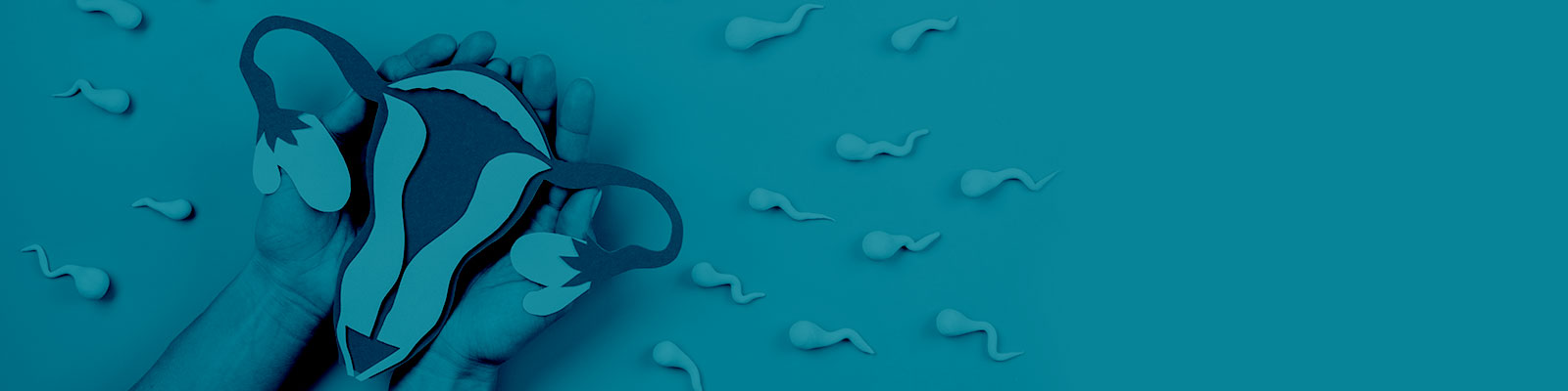 iui 