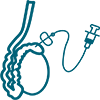 pesa