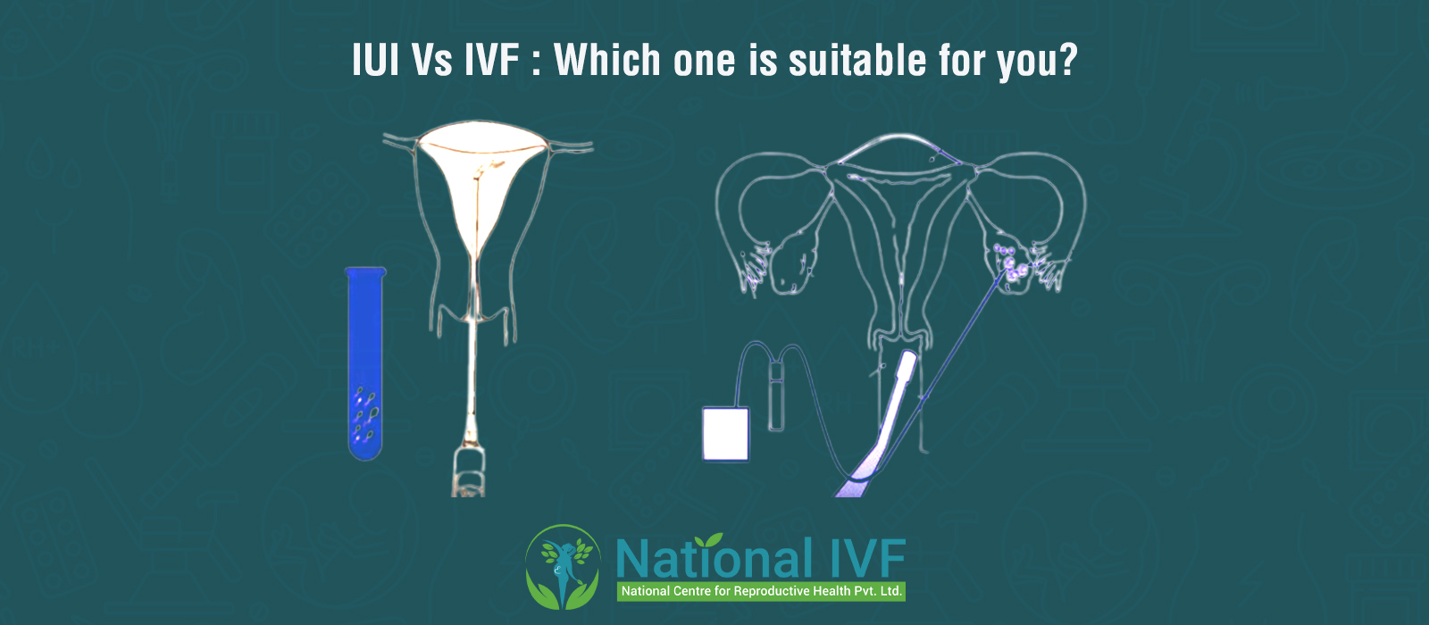 iui-vs-ivf 
